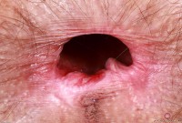 ATK hairy Sia Wood Set