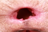 ATK hairy Sia Wood Set