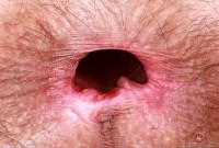 ATK hairy Sia Wood Set