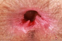 ATK hairy Sia Wood in young and hairy