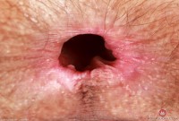 ATK hairy Sia Wood Set