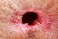 ATK hairy Sia Wood Set