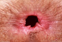 ATK hairy Sia Wood in young and hairy