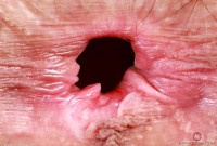 ATK hairy Sia Wood Set