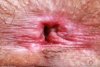 ATK hairy Sia Wood in young and hairy