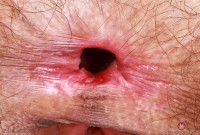ATK hairy Sia Wood in young and hairy