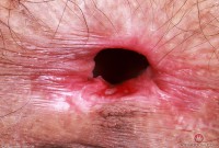 ATK hairy Sia Wood in young and hairy