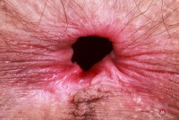 ATK hairy Sia Wood Set