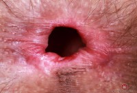 ATK hairy Sia Wood Set