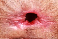 ATK hairy Sia Wood Set