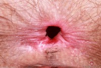 ATK hairy Sia Wood in young and hairy