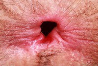 ATK hairy Sia Wood Set