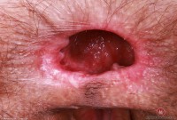 ATK hairy Sia Wood Set