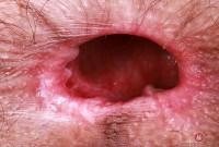 ATK hairy Sia Wood Set