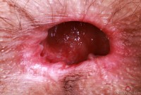 ATK hairy Sia Wood Set