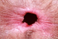 ATK hairy Sia Wood Set