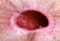 ATK hairy Sia Wood Set