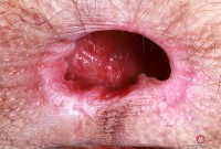 ATK hairy Sia Wood Set