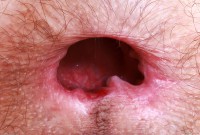 ATK hairy Sia Wood in young and hairy