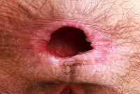 ATK hairy Sia Wood Set