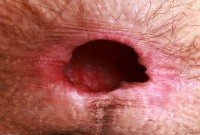 ATK hairy Sia Wood Set