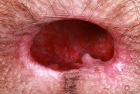 ATK hairy Sia Wood Set