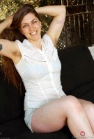 ATK hairy  in mature and hairy