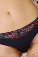 ATK hairy  in mature and hairy