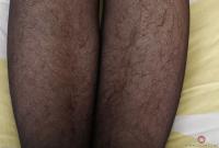 ATK hairy Simone Delilah in scary hairy