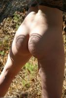 ATK hairy  in mature and hairy