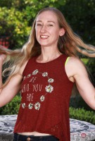 ATK hairy  in mature and hairy