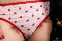 ATK hairy  in mature and hairy