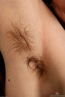 ATK hairy  in mature and hairy