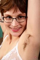 ATK hairy  in mature and hairy