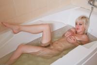 ATK hairy  in young and hairy