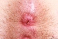 ATK hairy Stacey Barnes Set