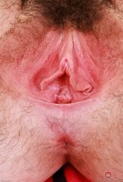 ATK hairy  in young and hairy