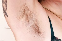 ATK hairy  in young and hairy