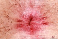 ATK hairy Stacey Barnes Set