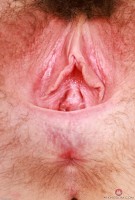 ATK hairy  in young and hairy