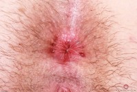 ATK hairy Stacey Barnes in young and hairy