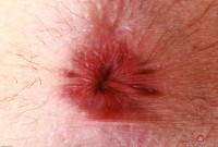 ATK hairy Stacey Barnes Set