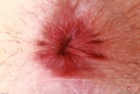 ATK hairy Stacey Barnes Set