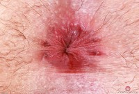 ATK hairy Stacey Barnes Set