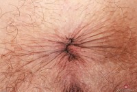 ATK hairy Summer Vixen Set