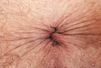 ATK hairy Summer Vixen Set