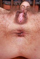 ATK hairy  in young and hairy