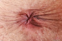 ATK hairy  in young and hairy