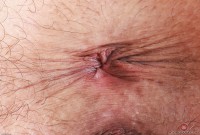 ATK hairy Summer Vixen Set