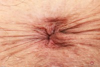 ATK hairy Summer Vixen Set